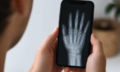 Aplicativo de Raio X no Celular: Veja Como Usar